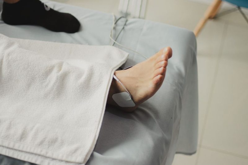 Best PiezoWave Therapy for Plantar Fasciitis in Naples