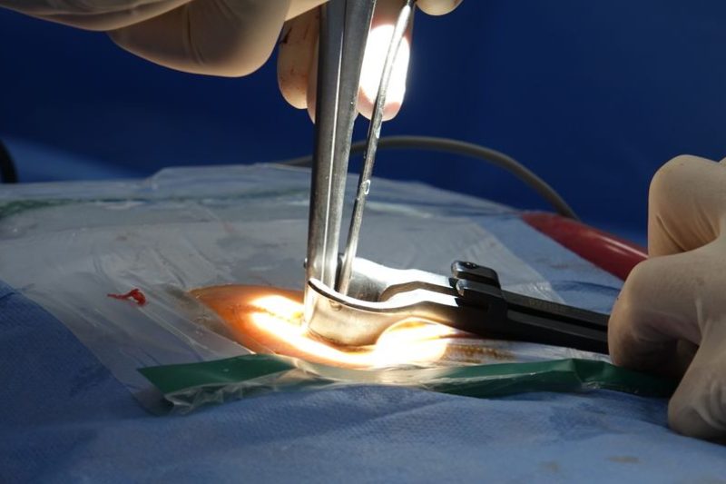 Spinal Decompression for Herniated Disc: How It Works