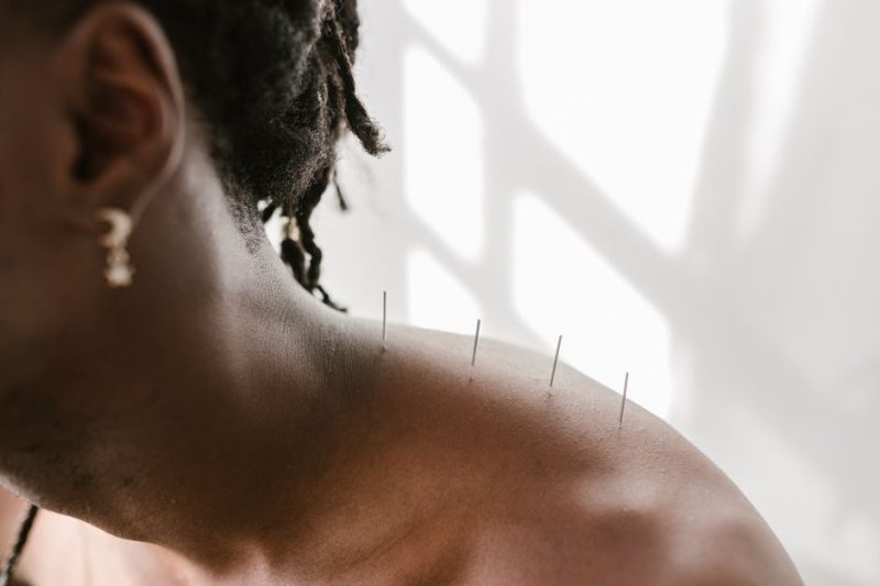 Best Acupuncture for Chronic Pain in Naples 2026: Top 5 Ranked